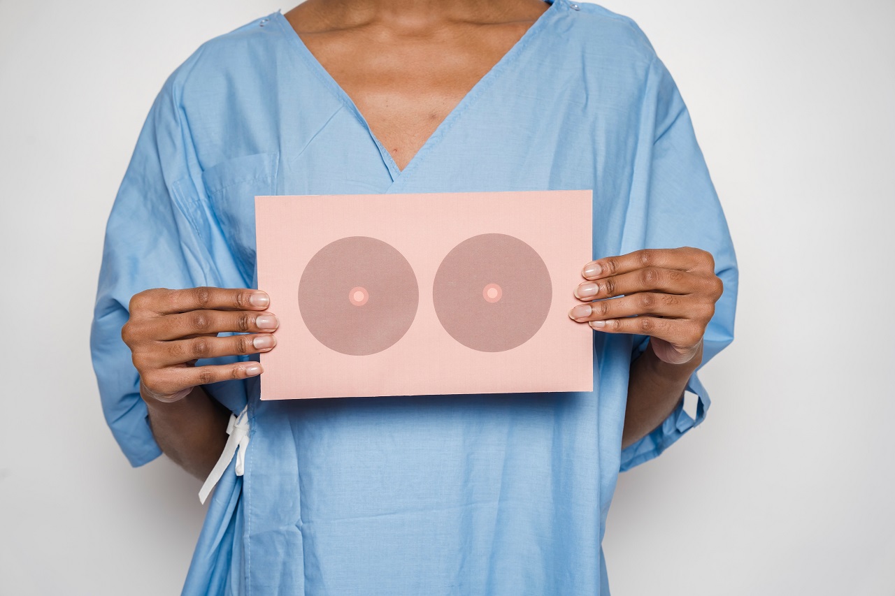 rakovina prsníka, mamografia