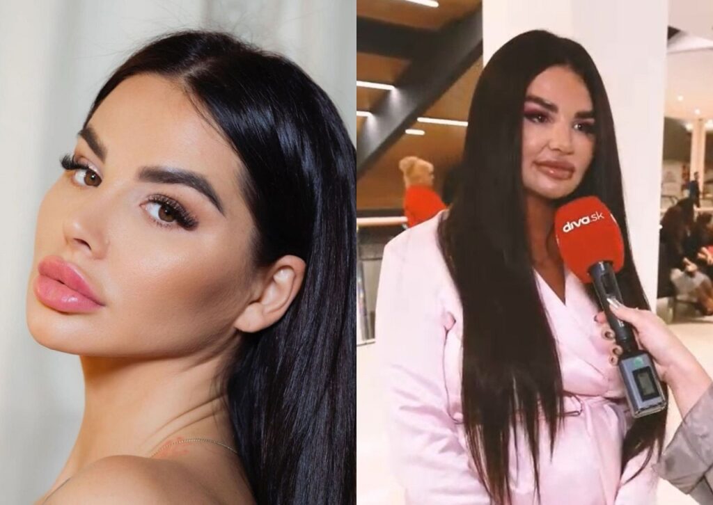 Zuzana Plačková, filtre, sociálne siete